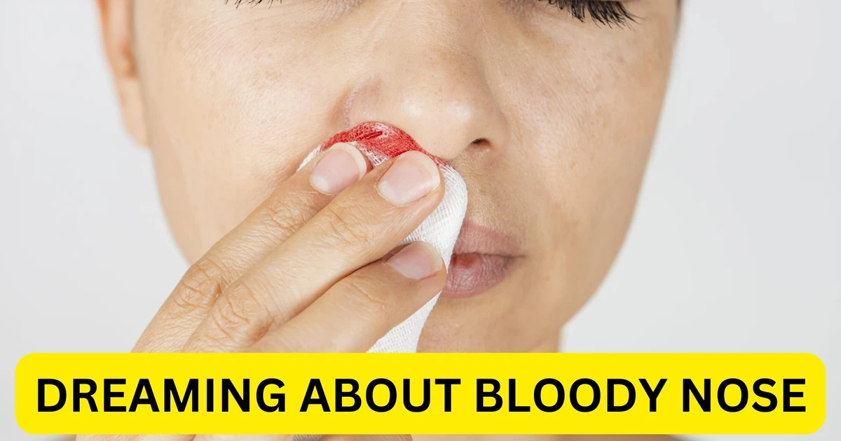 Is Dreaming About Bloody Nose A Sign Of Something Deeper?