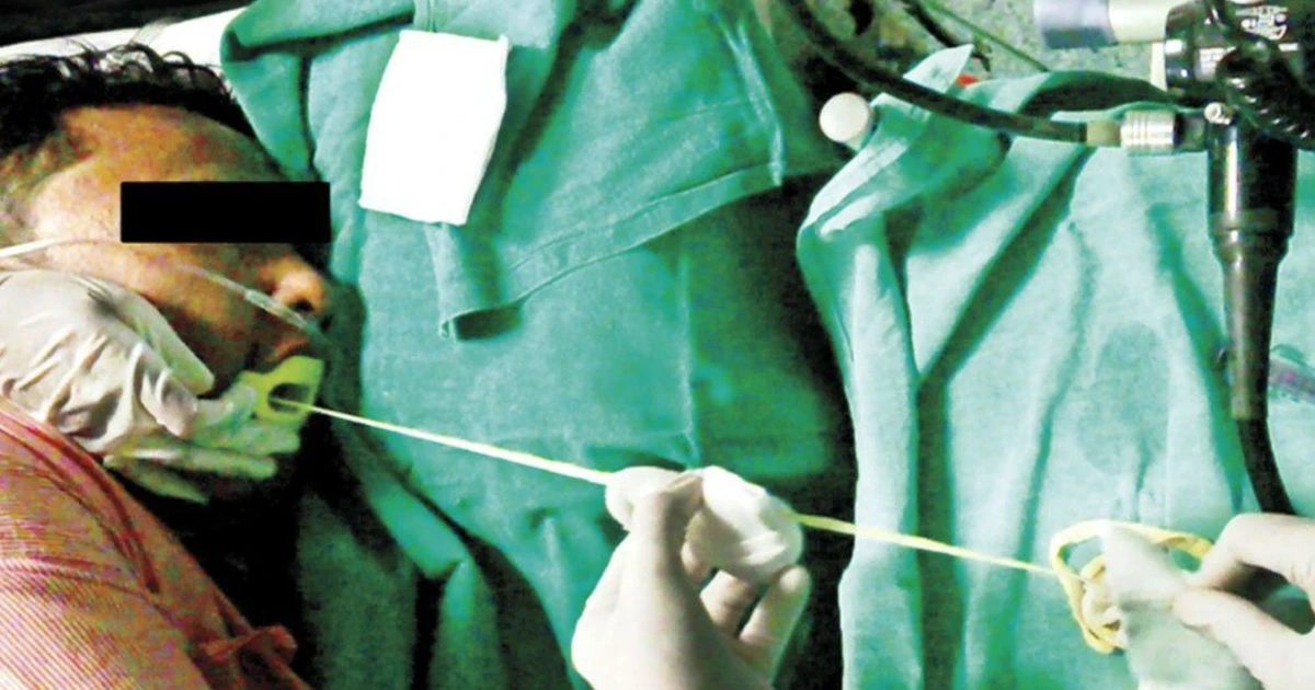 How Can Pulling Worms Out Of Mouth Dreams Be Interpreted In Different